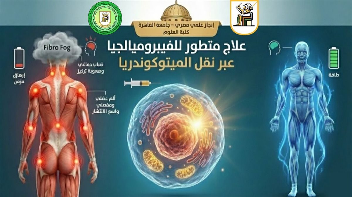 بحث كلية العلوم بجامعة القاهرة لمرض “الفيبروميالجيا”
