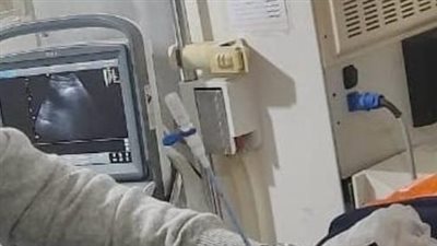 مستشفى دسوق العام: تركيب قسطرة كلوية بمساعدة الأشعة التليفزيونية لمريض بوحدة الكلي