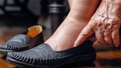 كيف تختار الحذاء المناسب لمريض السكر؟ 