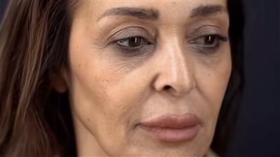 سر إطلالة داليا البحيري الجديدة بعد جراحة شد الوجه والجفون