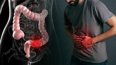 اكتشاف طبي مذهل: دواء لعلاج الإمساك يعزز الذاكرة ويحارب 