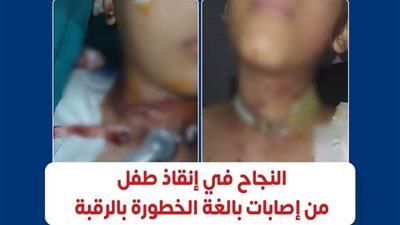 أبطال غرف العمليات.. معهد ناصر ينقذ طفلًا من إصابات مهددة للحياة