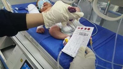 فحص 470 ألف طفل للكشف عن 19 مرضا وراثيا  