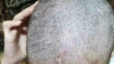 بسبب النقاب.. تعذيب فتاة على يد والدها وشقيقها