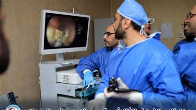 مستشفي كفر الشيخ الجامعي تطلق تقنية مناظير الفراغ الثالث لعلاج أمراض الجهاز الهضمي