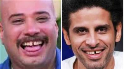 رامز جلال يسخر من فلقة أسنان حاتم صلاح: «أخيرًا حمدي الميرغني لقى منافس»