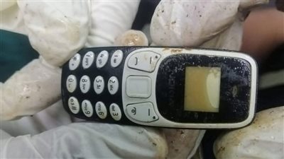 مستشفى الأزهر بأسيوط تستخرج هاتفًا محمولًا من معدة مريض ابتلعه منذ سنتين